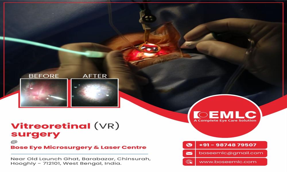 Discover the world of Vitreoretinal (VR) surgery at Bose EMLC Eye Hospital! 